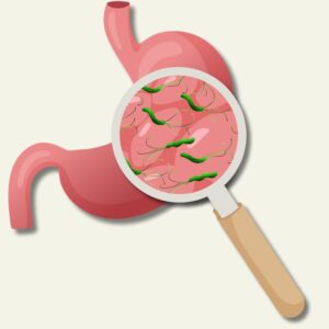 Image is a graphic of a magnifying glass showing H. pylori in the stomach. Stomach ulcers – what to know. Private Physicians Medical Associates. PPMA.