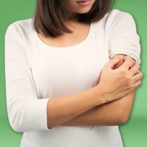 An image of a woman scratching a mosquito bite on her arm.