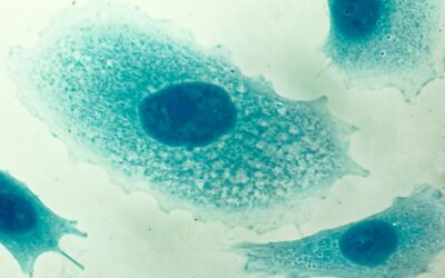 Prostate Nutrition Strategies | Nourish MD Podcast, S01 EP19