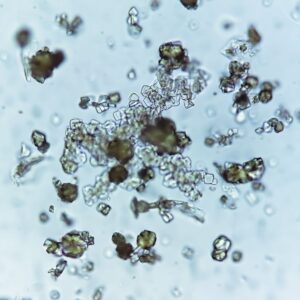 Bacteria from a UTI, from microscope image.