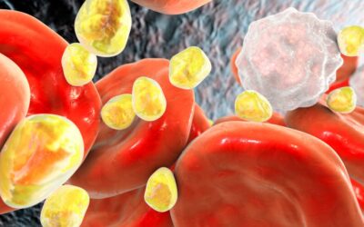 Cholesterol Basics: Good vs. Bad Cholesterol