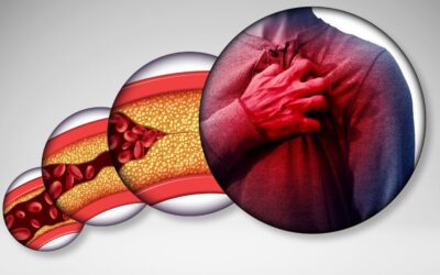 Heart Disease: How to Recognize the Symptoms Early