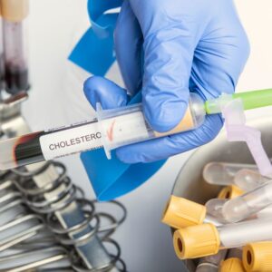 An image of a blue-gloved hand holding a cholesterol blood test tube.