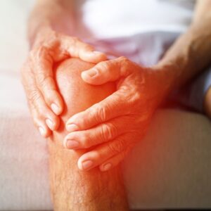 Inflammation of the knee.